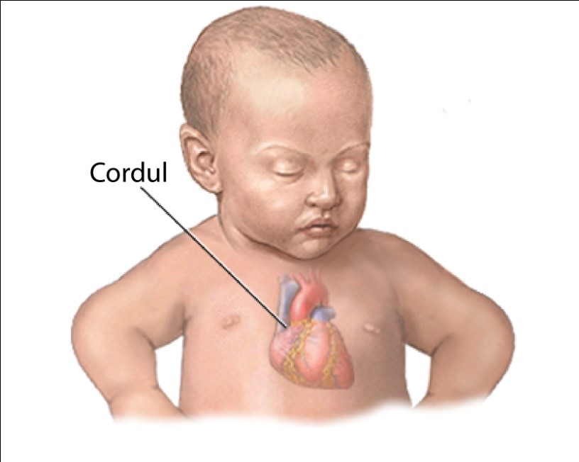 Tip de malformație cardiacă