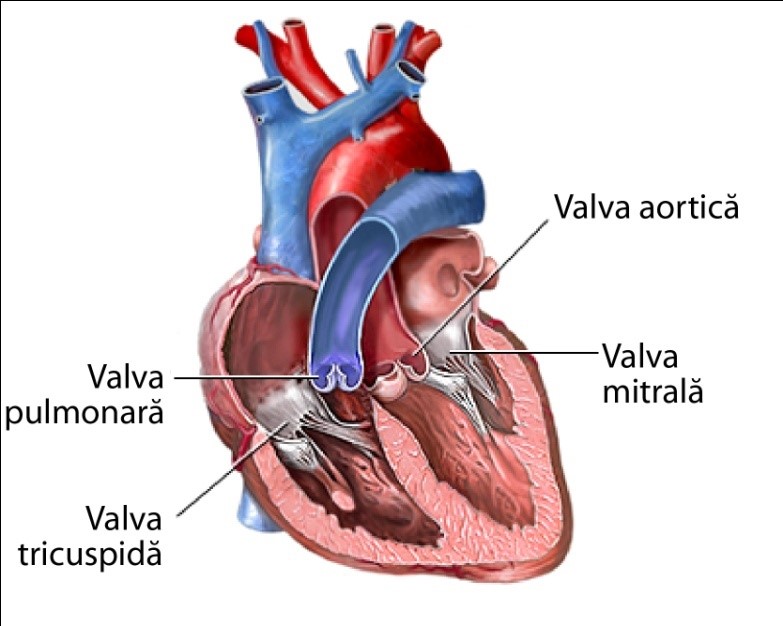 Stenoza pulmonară – schemă