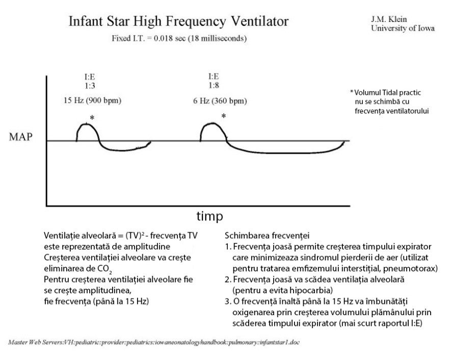 Ventilator Infant Star 950 - schema
