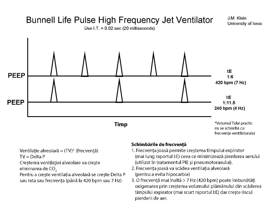 Ventilator Bunnell Life Pulse