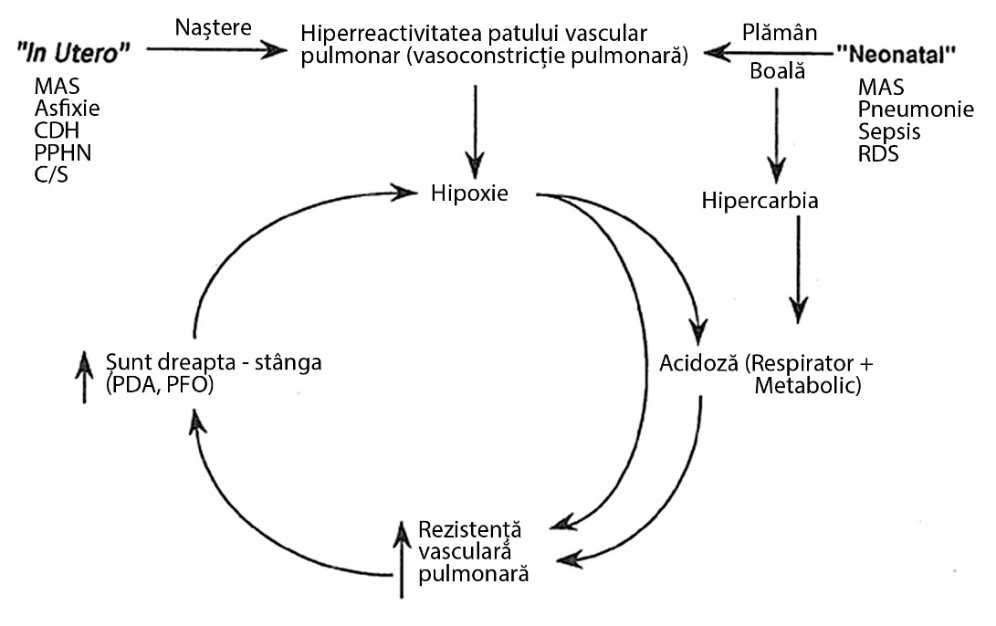 Ilustrație privind hipertensiunea pulmonară la nou-născut