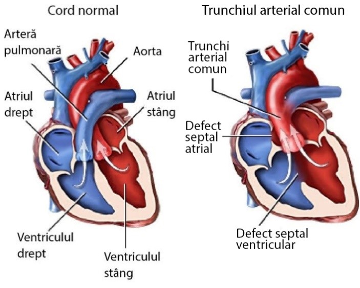 Trunchi arterial comun - schemă